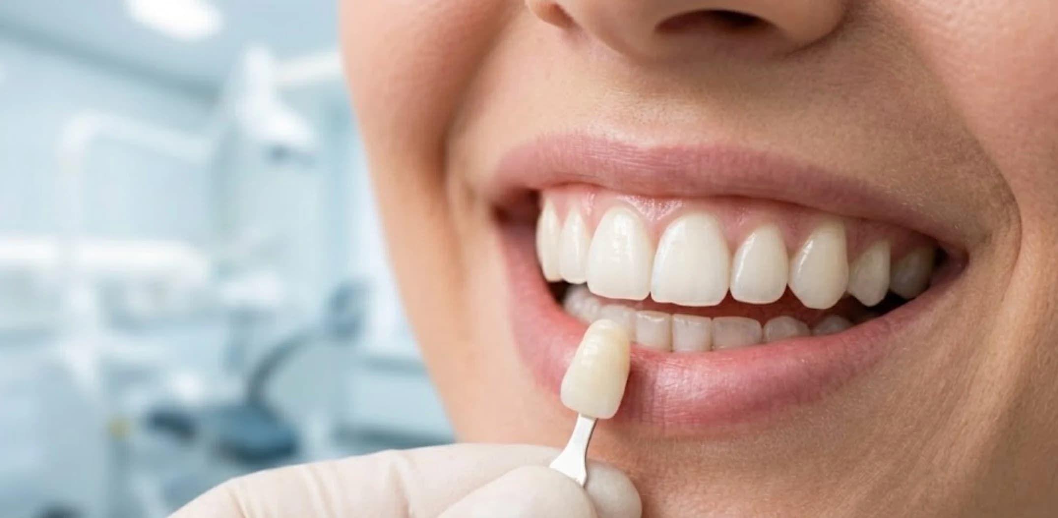 Estetsko zobozdravstvo