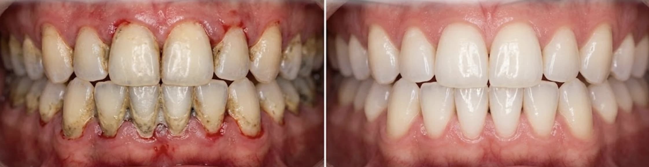 Preventiva in higiena