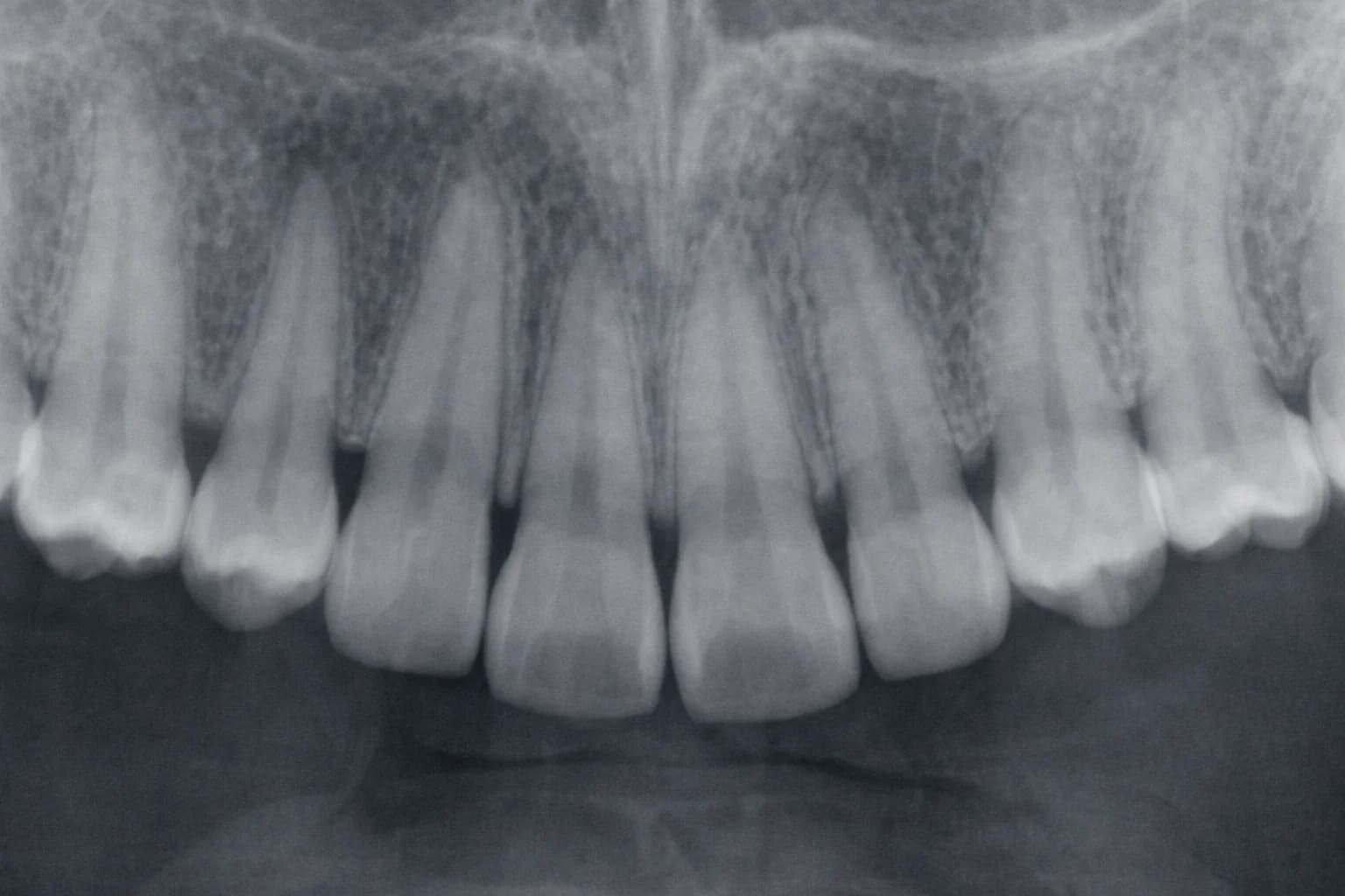 Celotni stomatološki pregled in diagnostika